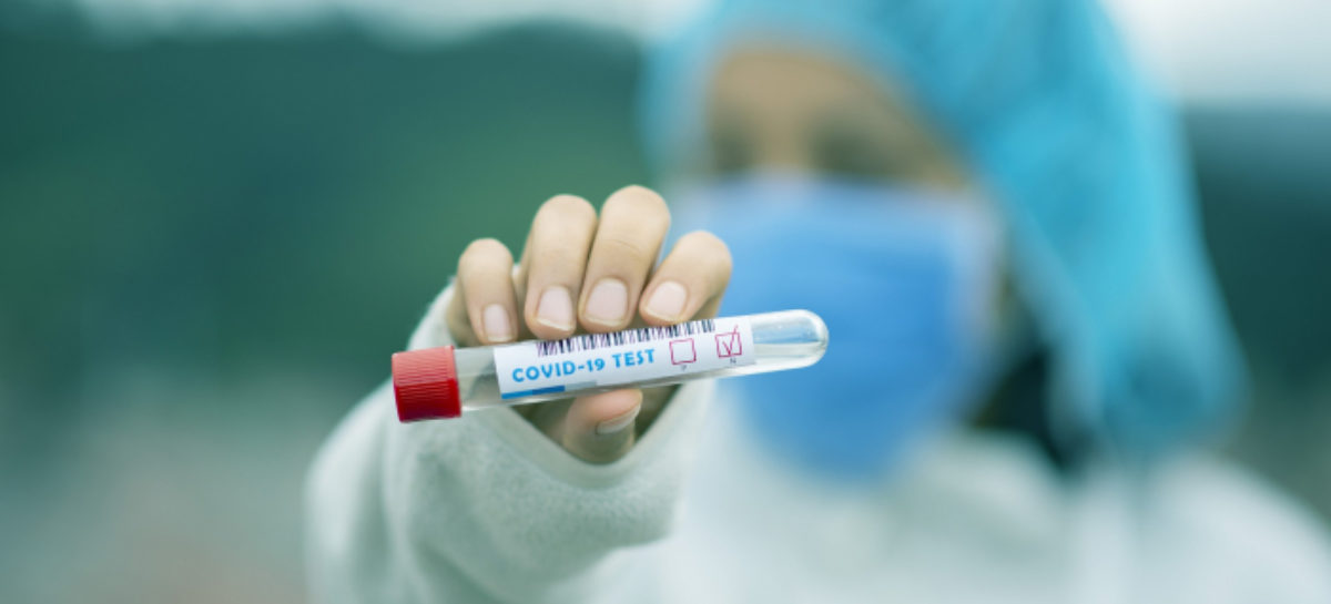 Falta de informação sobre Covid-19 em locais de trabalho atrasa combate à pandemia