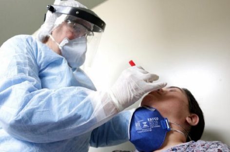 Governo Bolsonaro deixa estragar 6,8 milhões de testes de Covid-19