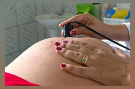 Congresso aprova PL que garante teletrabalho para gestantes durante pandemia