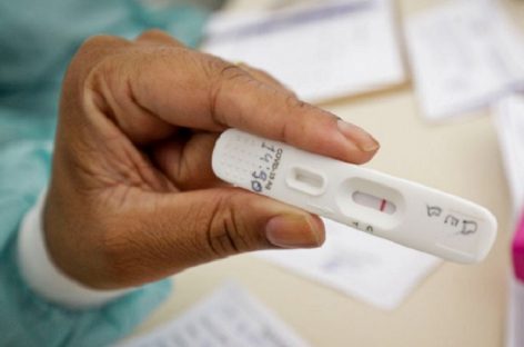 Anvisa libera o uso de autotestes para detecção da covid-19