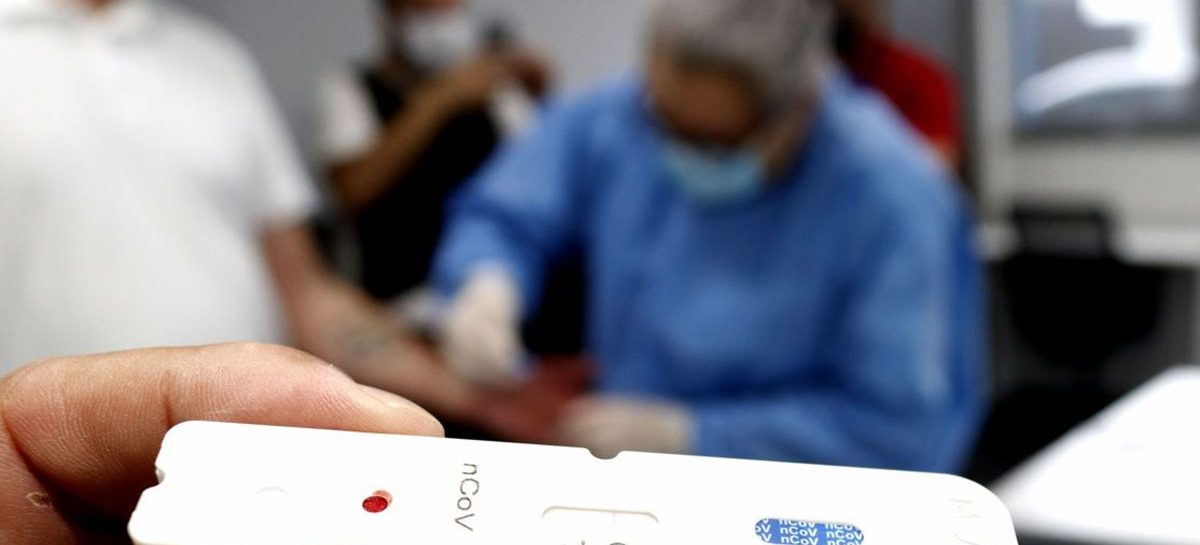 País volta a registrar índice de mortes de novembro. Avanço da ômicron exige política de testagem