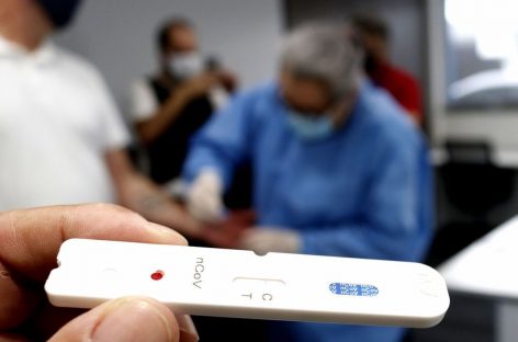 País volta a registrar índice de mortes de novembro. Avanço da ômicron exige política de testagem