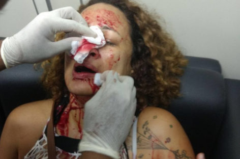 Após truculência contra servidores, reforma de Doria é aprovada na CCJ